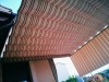 Instalación de Pérgola Cenador en Collado Mediano